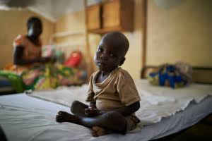 RDC : PLUS DE 48 % D’ENFANTS DE 0 À 5 ANS TOUCHÉS PAR LA MALNUTRITION